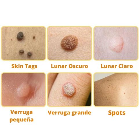 DermaBEE Manchas en la piel 021